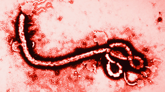 ebola-virus-magnified.jpg