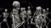 Skeletton 2.gif