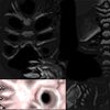 Tortured Soul.jpg
