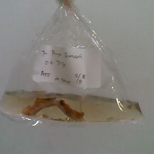 My appendix