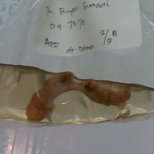 My appendix from another view