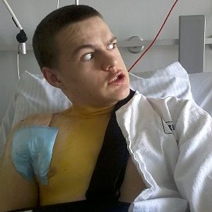 Insane patient