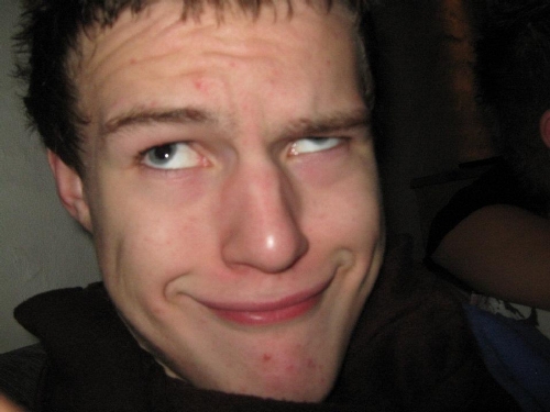 Me doing the Derpy face! :D