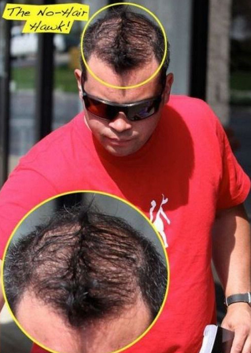 no hair hawk