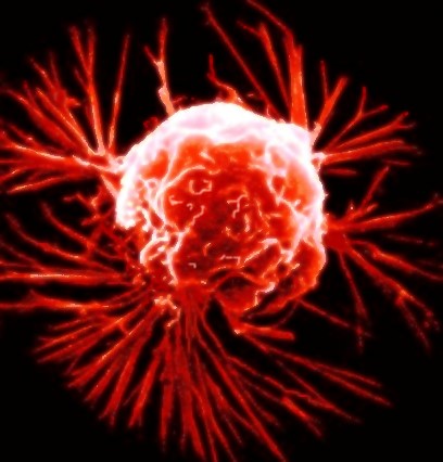 CancerCell222.jpg