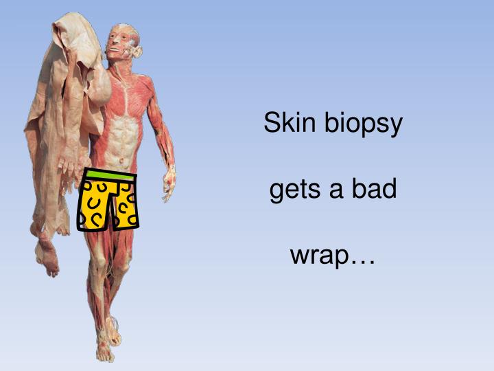 skin-biopsy-gets-a-bad-wrap-n.jpg